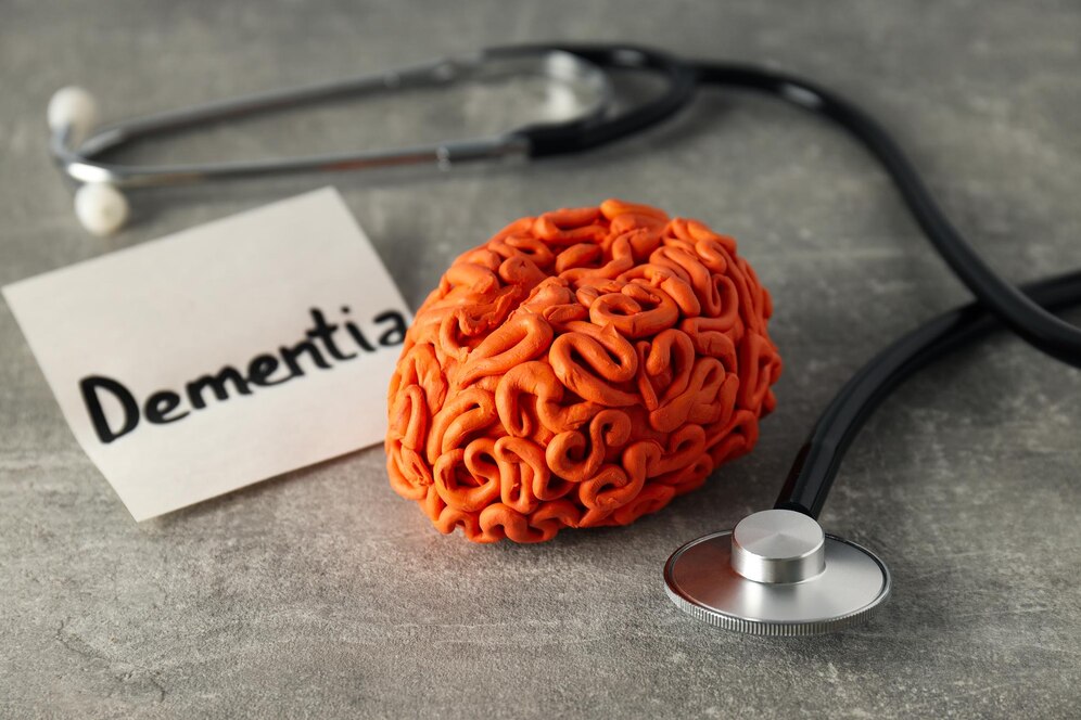 Model of brain with dementia label and stethoscope on gray background.
