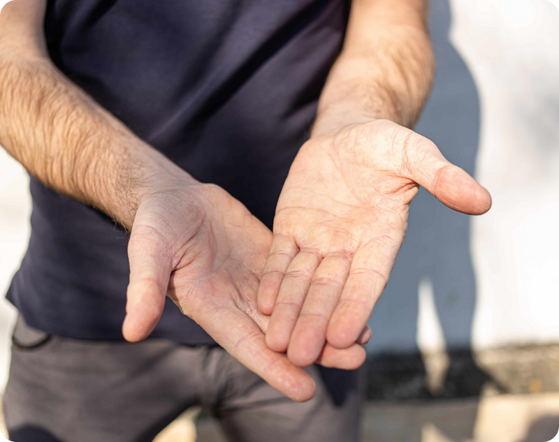 A person practicing arm stabilization exercise outdoors, demonstrating tremor relief