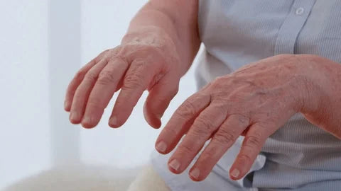 Close-up of an elderly person's hands held out in front with slight tremor, illustrating hand shaking, arthritis, or Parkinson’s Disease symptoms.