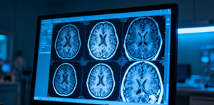 Parkinsonian Tremor: Phenomenology and Pathophysiology