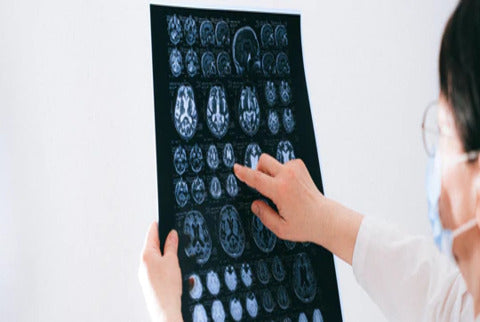 Does Essential Tremor Show Up on MRI?