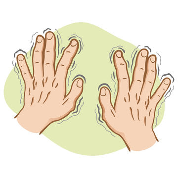 Animation of hands shaking with signs of essential tremors.